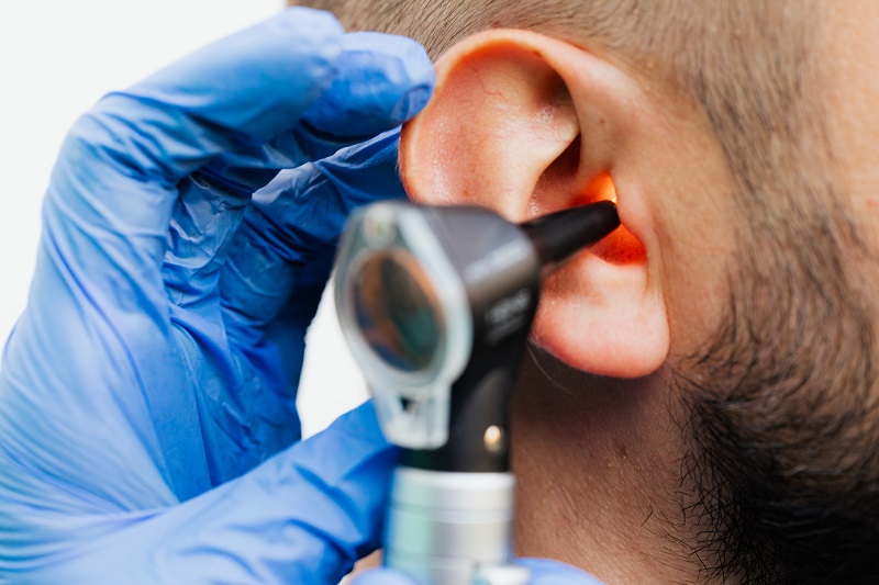 Can CBD Help Tinnitus Close Up of a Man's Ear While a Doctor Inspects the Inside of His Ear